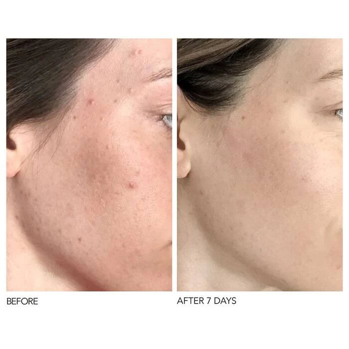 Daily Peel 60 Treatments G163